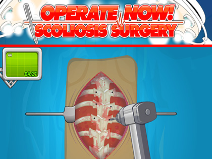 Operate Now Scoliosis Surgery
